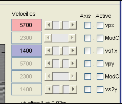 speed settings